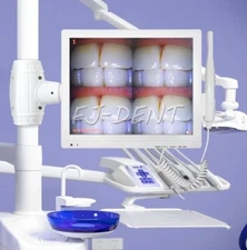 16 Milion Digital Dental Camera Oral Camera Wireless WiFi 17inch Screen Monitor
