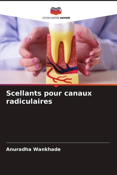Scellants Pour Canaux Radiculaires Anuradha Wankhade Taschenbuch FranzöSisch-image