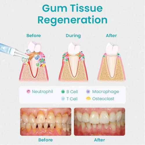 1-10 piezas NESLEMY Gum Shield Therapy Gel NESLEMY Goma Shield Gel Dentizens - Imagen 2 de 20