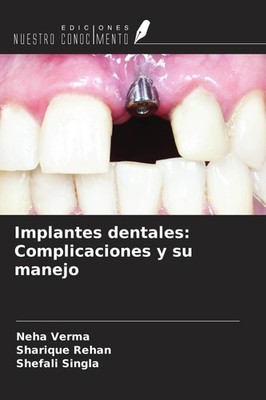 Implantes dentales: Complicaciones y su manejo Neha Verma