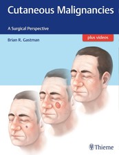 Brian Gastman ~ Cutaneous Malignancies 978162...
