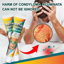 20g Genital Wart Removal Cream Skin Treatment Fast Acting Formula