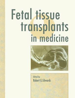 Fetal Tissue Transplants in Medicine Edwards Paperback 9780521116923