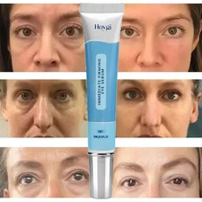 Rapid Reduction Eye Cream Reduce Under- Eye Bags, Wrinkles, Dark Circles