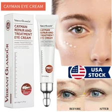 Collagen Eye Cream Whitening Anti Aging Wrinkles Remove Eye Bags Dark Circles US