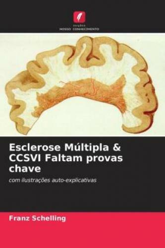 Esclerose Múltipla & Ccsvi Faltam Provas Chave Com Ilustrações