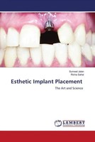 Sumeet Jalan (U. A.) | Esthetic Implant Placement | Taschenbuch | Englisch