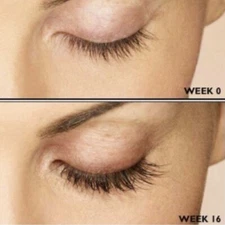 Best Lash Growth Solution