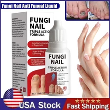 Fungi Nail Anti Fungal Liquid Formula Nail Repair Liquid Solution