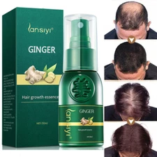 Ginger Hair Growth Serum Essence for Scalp Regrowth Thin Bald Hair Serum Oil