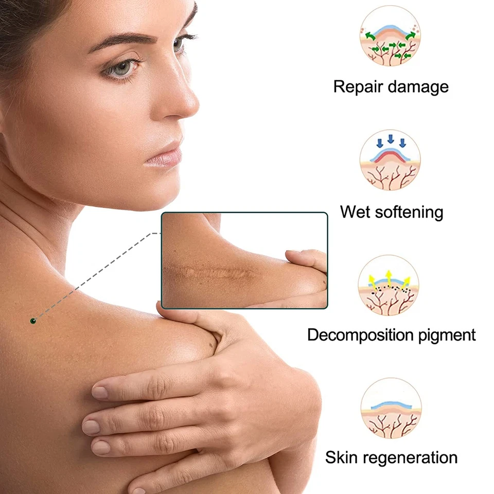 Scar Silicone Sheet Gel Patch Removal Skin Treatment Repair Wound Burn Natural - Image 2 of 4