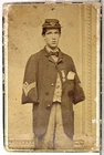 1860s UNION ARMY CIVIL WAR SOLDIER DOUBLE AMPUTEE CDV PHOTO - ALFRED STRATTON
