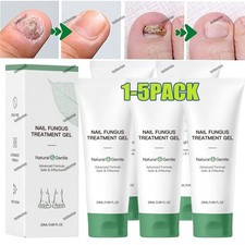 5X Nutraboost Nail Fungus Treatment Gel, Nail Fungus, Fungus Cream US (-20%OFF)