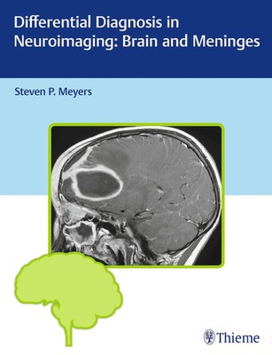 Differential Diagnosis in Neuroimaging: Brain and Meninges | Steven P Meyers