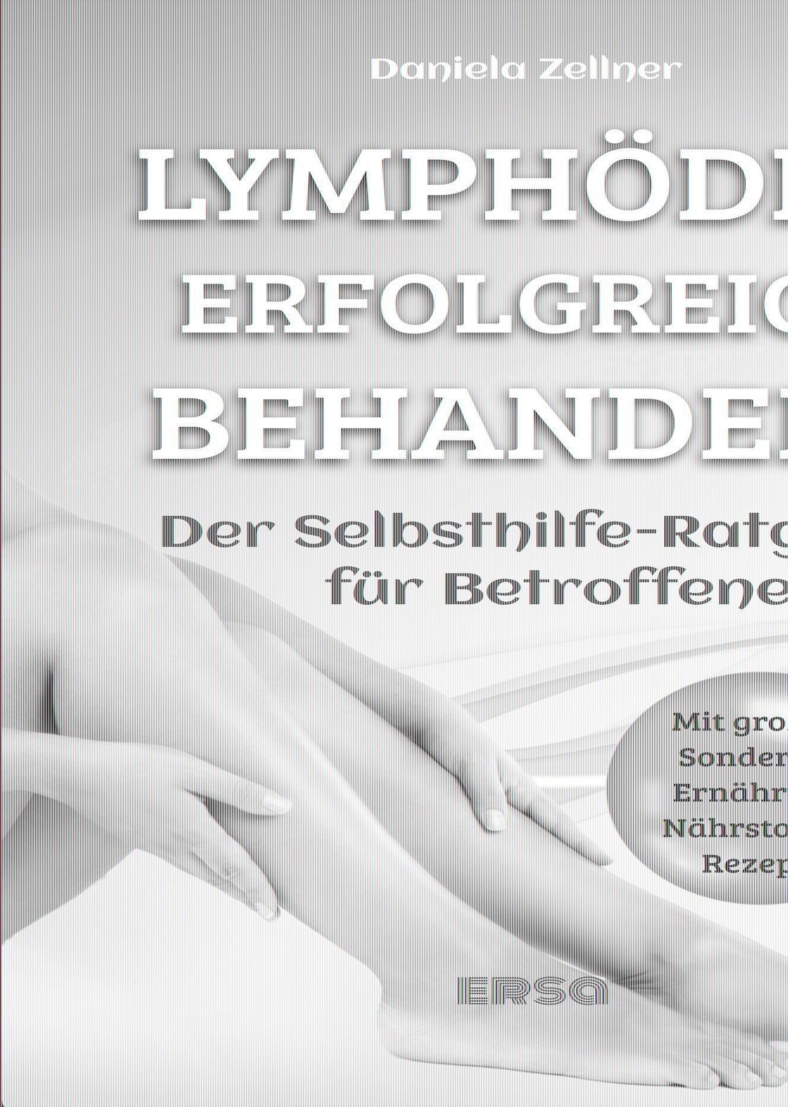 Thumbnail - Lymphödem Erfolgreich Behandeln | Der Selbsthilfe-ratgeber Für