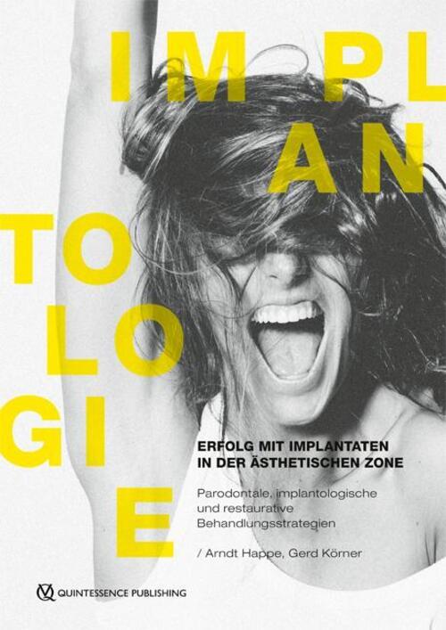 Erfolg Mit Implantaten In Der Ästhetischen Zone | Arndt Happe (u. A.)
