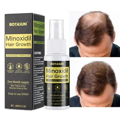 BOTASUN 60ml Minoxidil 5% Extra Strength Hair Growth Spray Fast Regrowth Scalp Treatment
