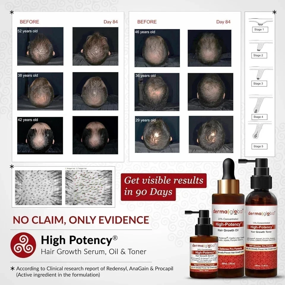 Derma Global High Potency Hair Serum - Root Strength & Volume Formula