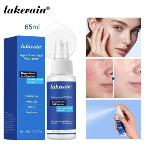 Hypochlorous Acid Facial Spray First Aid Spray Acne Removal Rapid Spot V59C - Picture 4 of 15