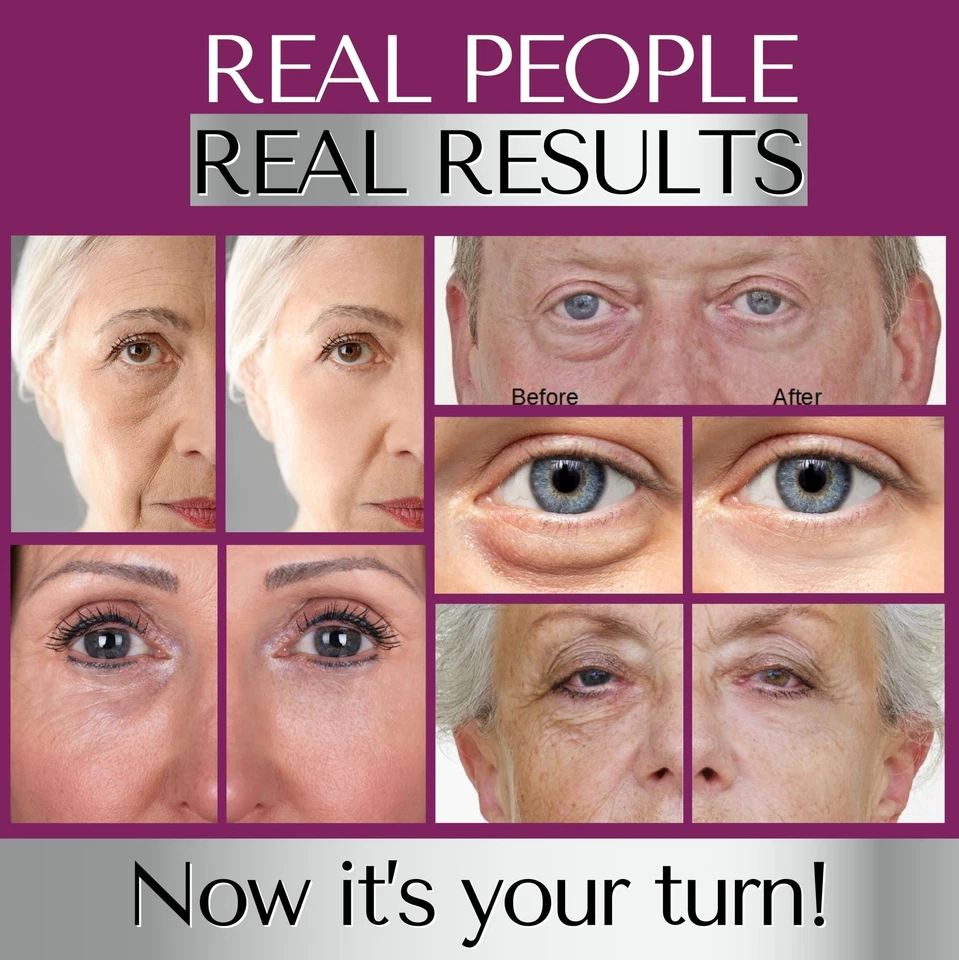 INSTANT WRINKLE Eye Tightener Cream Wrinkle Remover Serum with Argireline - Image 4 of 4