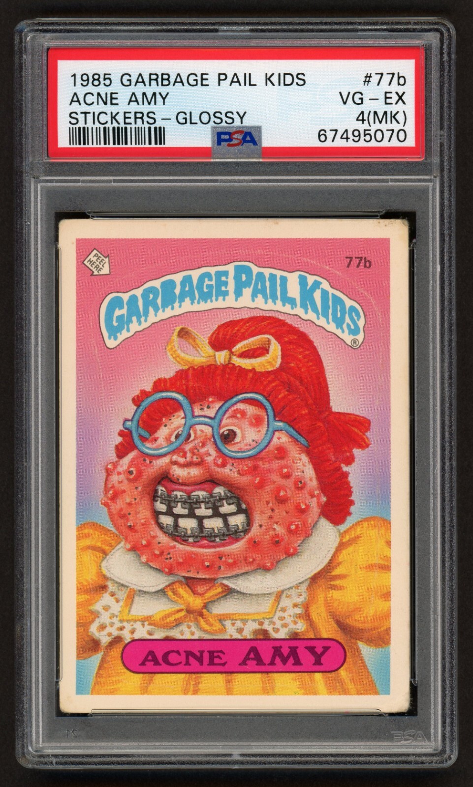 1985 Garbage Pail Kids Acne Amy #77b PSA 4 Glossy Sticker VG-EX 1st Year MK
