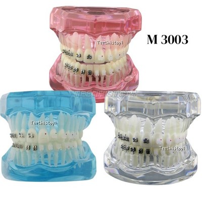 Dental Orthodontic Teeth Study Model with Metal Ceramic Bracket Braces 3003