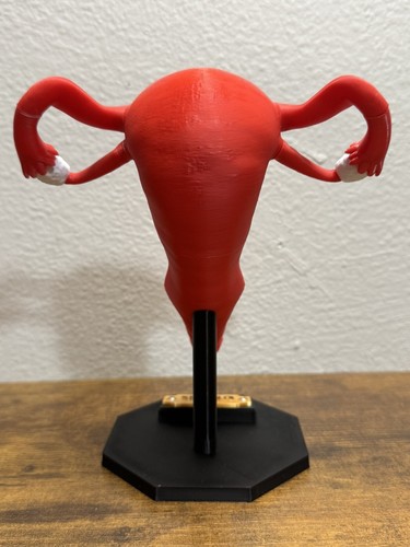 School teaching Pathological Anatomical Model Human Female Uterus 3D Printed - Picture 3 of 4
