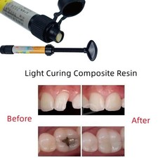 New Dental Cement Tooth Cavity Filling Kit | Strong Permanent Repair Restoration