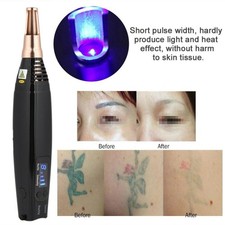 NEW Blue Light Picosecond Laser Tattoo Removal Pen Skin Dark Spot Remover