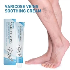 La crema para venas varicosas de acción rápida reduce la hinchazón 💲50% OFF💲