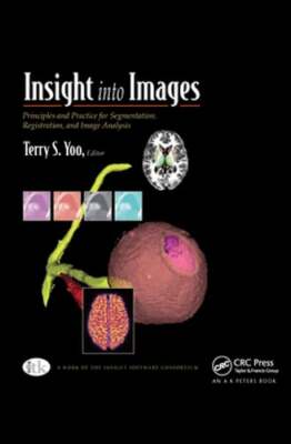 Insight into Images: Principles and Practice for Segmentation, Registration, and