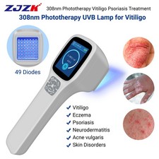 ZJZK 308nm UVB Light Phototherapy Device for Skin Diseases Treatment 49 Diodes