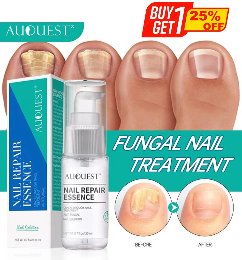 Antifungal for toenails deals