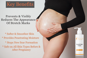 post delivery stretch marks removal cream