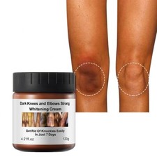 Strong Whitening Cream For Intimate Areas  Dark Knuckle Finger Elbow and Knee