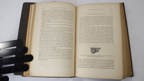 The Diseases of the Ear: Their Nature, Diagnosis and Treatment by Joseph Toynbee - Picture 4 of 7