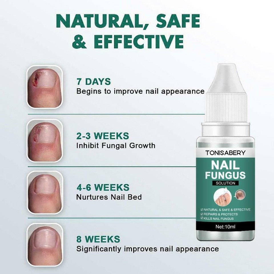 Fungal Nail Repair Essence Serum Care Treatment Foot Removal Fungus J9K