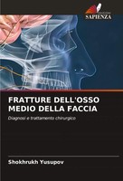 Fratture Dell'osso Medio Della Faccia Diagnosi E Trattamento Chirurgico Yusupov
