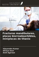 Vijayendra Kumar (U. A.) | Fracturas Mandibulares, Placas Biorreabsorbibles,...