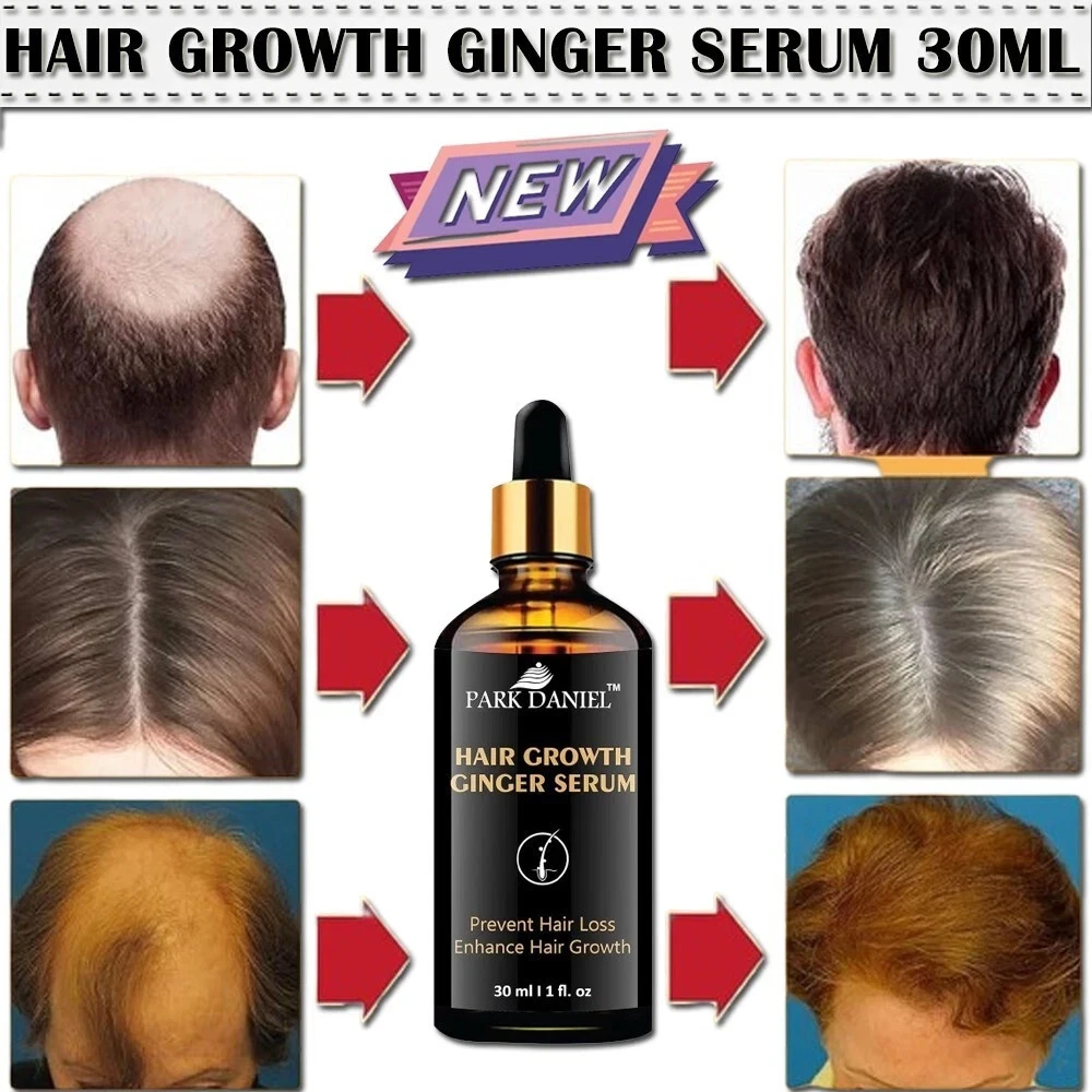 Hair Growth Serum Boost Hair Growth, DHT Blocker Reduce Hair Loss 30ml - 2 Pack