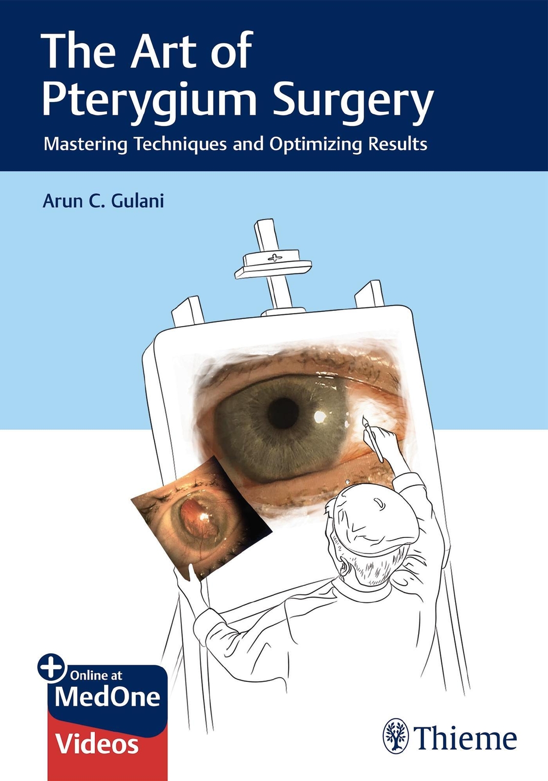 Thumbnail - Arun C Gulani | The Art Of Pterygium Surgery | Buch | Englisch (2019)