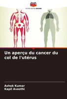 Un AperçU Du Cancer Du Col De L'utéRus Ashok Kumar (U. A.) Taschenbuch 2024