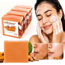 6x Kojic Acid Soap Bars Dark Spot Remover Turmeric Brightening Face Body Skin
