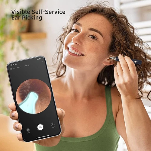Smart Ear Wax Removal Pick LED Wireless Ear Camera Otoscope Visual Ear Cleaner - Bild 8 von 19