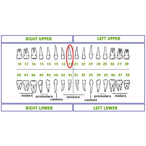 Columbia 860 Style Dental Typodont Model Licensing Exam 32 Pcs Removable Teeth - Picture 38 of 46