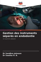 Gestion Des Instruments SéParéS En Endodontie Un Examen DéTaillé Johnson (U. A.)