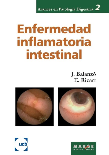 Elena Ricart GóMez (U. A.) | Enfermedad Inflamatoria Intestinal | Taschenbuch-image
