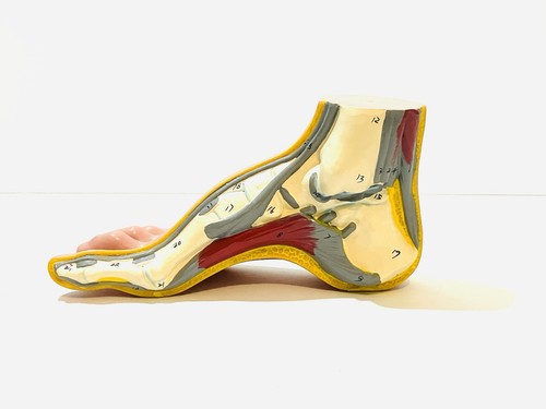 Life Size Anatomical High Arched Foot Medical Model