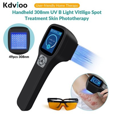 308nm Excimer Lamp Therapy Light Home Use Phototherapy Device For Skin Diseases