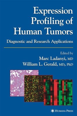 Expression Profiling of Human Tumors William L. Gerald